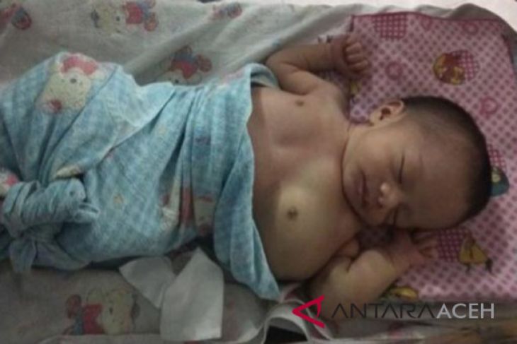 Bayi derita tumor ganas butuh donasi