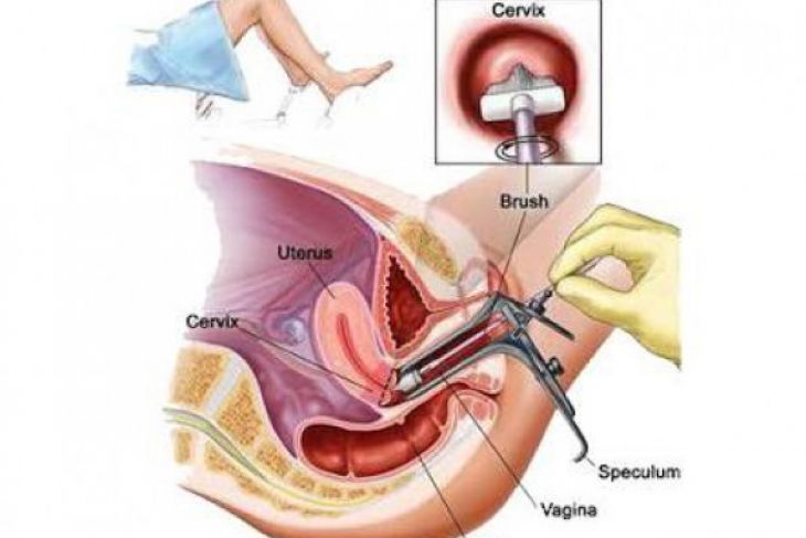 Dinkes ambon ajak kaum perempuan tes IVA