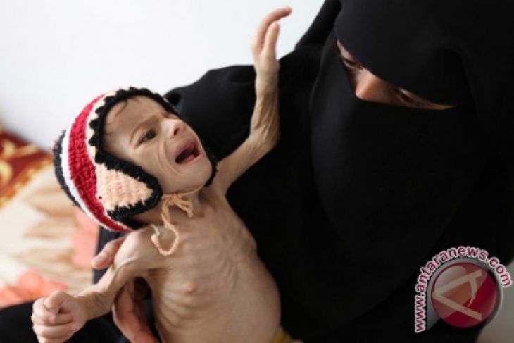Pejabat PBB prihatin mengenai impor makanan ke Yaman