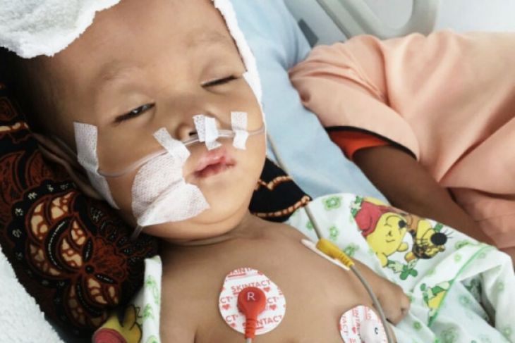 Lintang, bayi pengidap peradangan otak di Jambi butuh uluran tangan