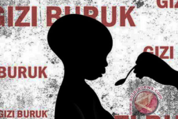 Jumlah kasus gizi buruk di Penajam turun